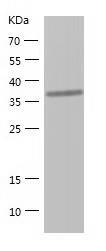 Recombinant Human FIBP.jpg