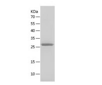 Recombinant Human Fibrillarin.png