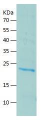 Recombinant Human FKBP14.jpg