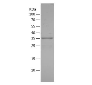 Recombinant Human FOXO1.png
