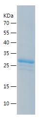 Recombinant Human FOXP3.jpg