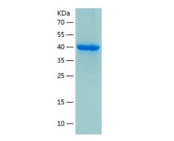 Recombinant Human GALK1.png