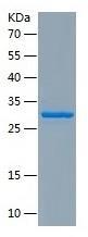 Recombinant Human GAMT.jpg