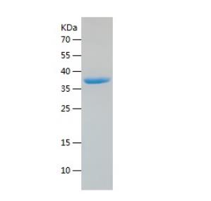 Recombinant Human GAPDH.png