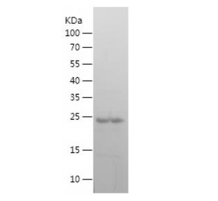 Recombinant Human GATA3.png