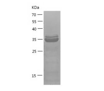 Recombinant Human GATA4.png