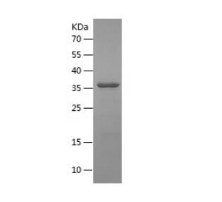 Recombinant Human GBA.png