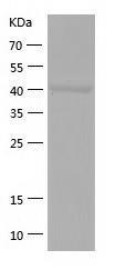 Recombinant Human GCDH.jpg