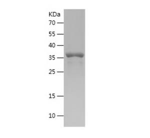 Recombinant Human GDF1.png