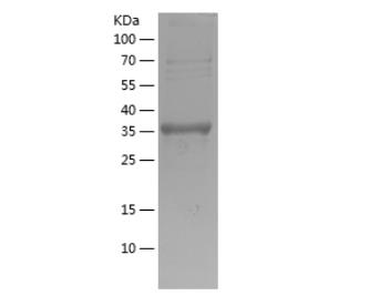 Recombinant Human GDF5.png
