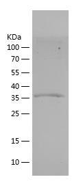 Recombinant Human GDF8.jpg