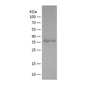 Recombinant Human GDF9.png