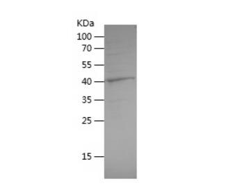 Recombinant Human GDI2.png