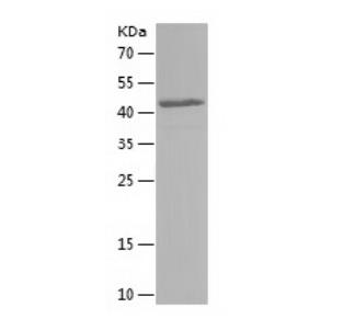 Recombinant Human GGPS1.png