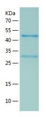 Recombinant Human GIMAP5.jpg