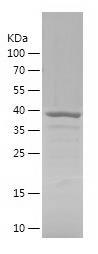 Recombinant Human GIPC2.jpg