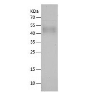 Recombinant Human GLA.png