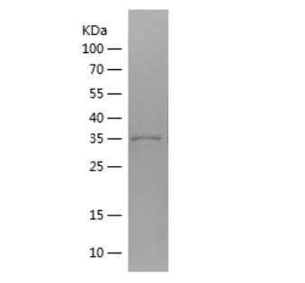 Recombinant Human GLS.png