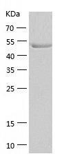 Recombinant Human Glucokinase.jpg