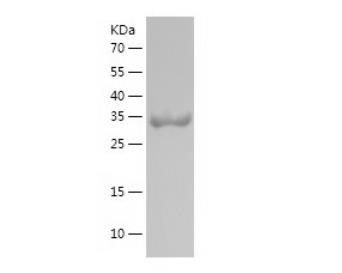 Recombinant Human Glutathione Peroxidase 3.png