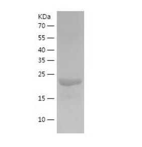 Recombinant Human Glutathione Reductase.png