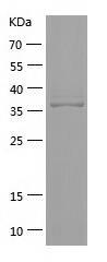 Recombinant Human GPD1L.jpg