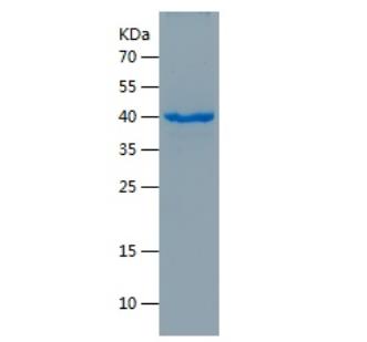 Recombinant Human GREM1.png