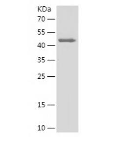 Recombinant Human GSTA4.png