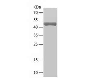 Recombinant Human GSTM3.png
