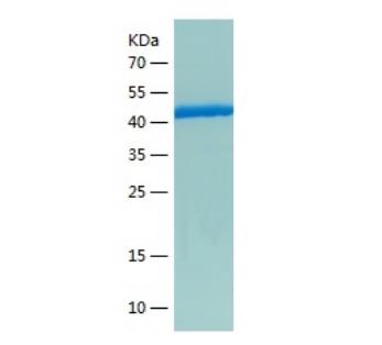 Recombinant Human GSTZ1.png