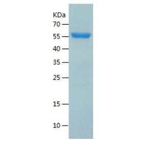 Recombinant Human HARS.png