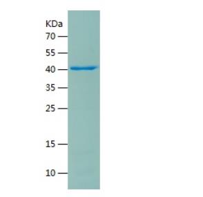 Recombinant Human HDAC2.png