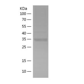 Recombinant Human HK3.png