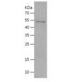 Recombinant Human HLA E.png