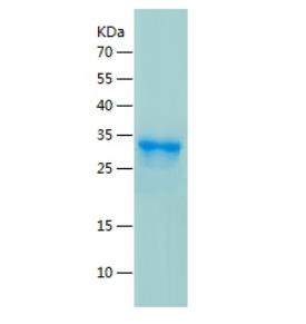 Recombinant Human HMGCR.png