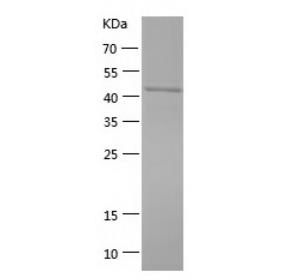 Recombinant Human HPD.png