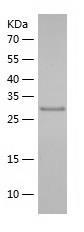 Recombinant Human HPSE2.jpg
