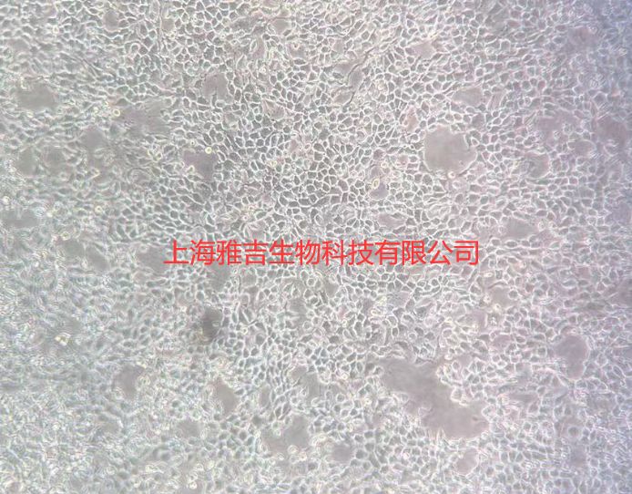人正常胰腺导管上皮细胞系HPDE6C7（STR）